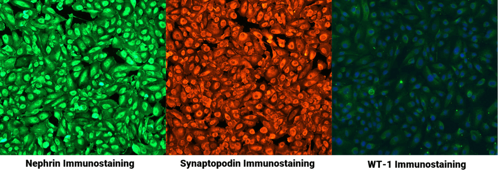 Innoprot, Podocyte, ポドサイト